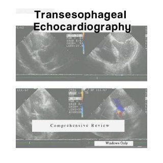 PTE Exam / TEE Review Comprehensive Transesophageal Echocardiography ; Video CDROM 3 Hour Review, Transesophageal Echocardiogarphy Exam Win PC's Only: Jacob Cestkowski, Roland Oettinger, Carl Massie, Alesia O'Doherty: 0091131175989: Books