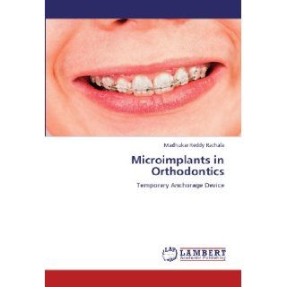 Microimplants in Orthodontics: Temporary Anchorage Device: Madhukar Reddy Rachala: 9783847312062: Books