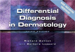 Differential Diagnosis in Dermatology (9781857756609): Richard Ashton, Barbara Leppard: Books
