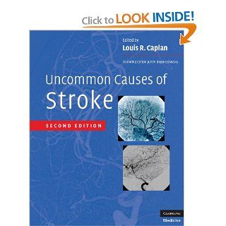 Uncommon Causes of Stroke (9780521874373): Louis R. Caplan, Julien Bogousslavsky: Books
