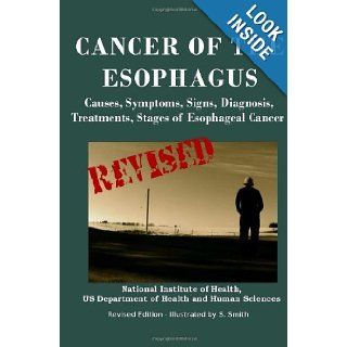 Cancer Of The Esophagus Causes, Symptoms, Signs, Diagnosis, Treatments, Stages of Esophageal Cancer U.S. Department Of Health And Human Services, National Institutes of Health, National Cancer Institute, S. Smith 9781475005455 Books